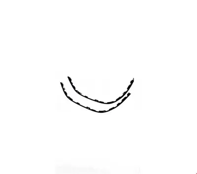 VORTEX V2809223 On Tampon Spoyleri Set P308 11> V2809223